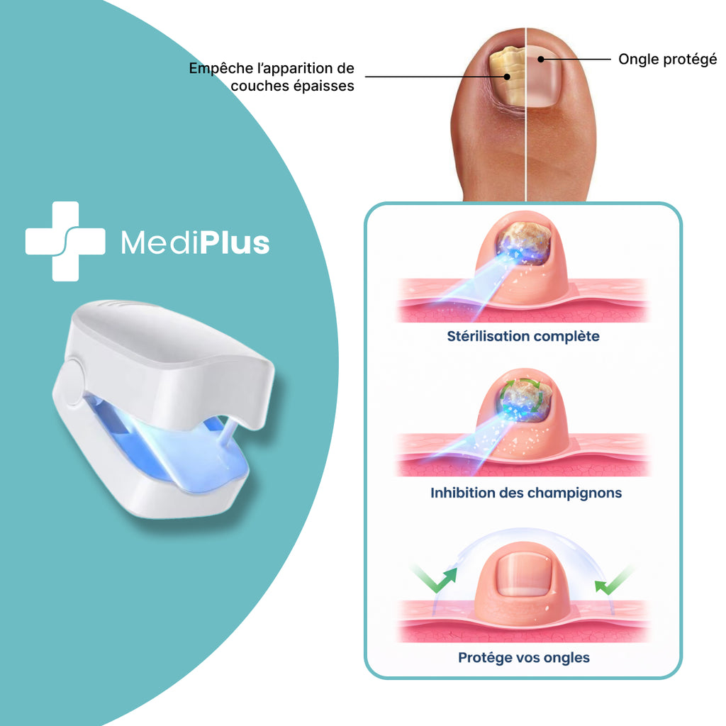Appareil Anti-Mycose MediPlus©