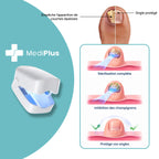 Appareil Anti-Mycose MediPlus©