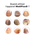 Appareil Anti-Mycose MediPlus©