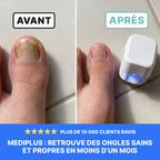 Appareil Anti-Mycose MediPlus©