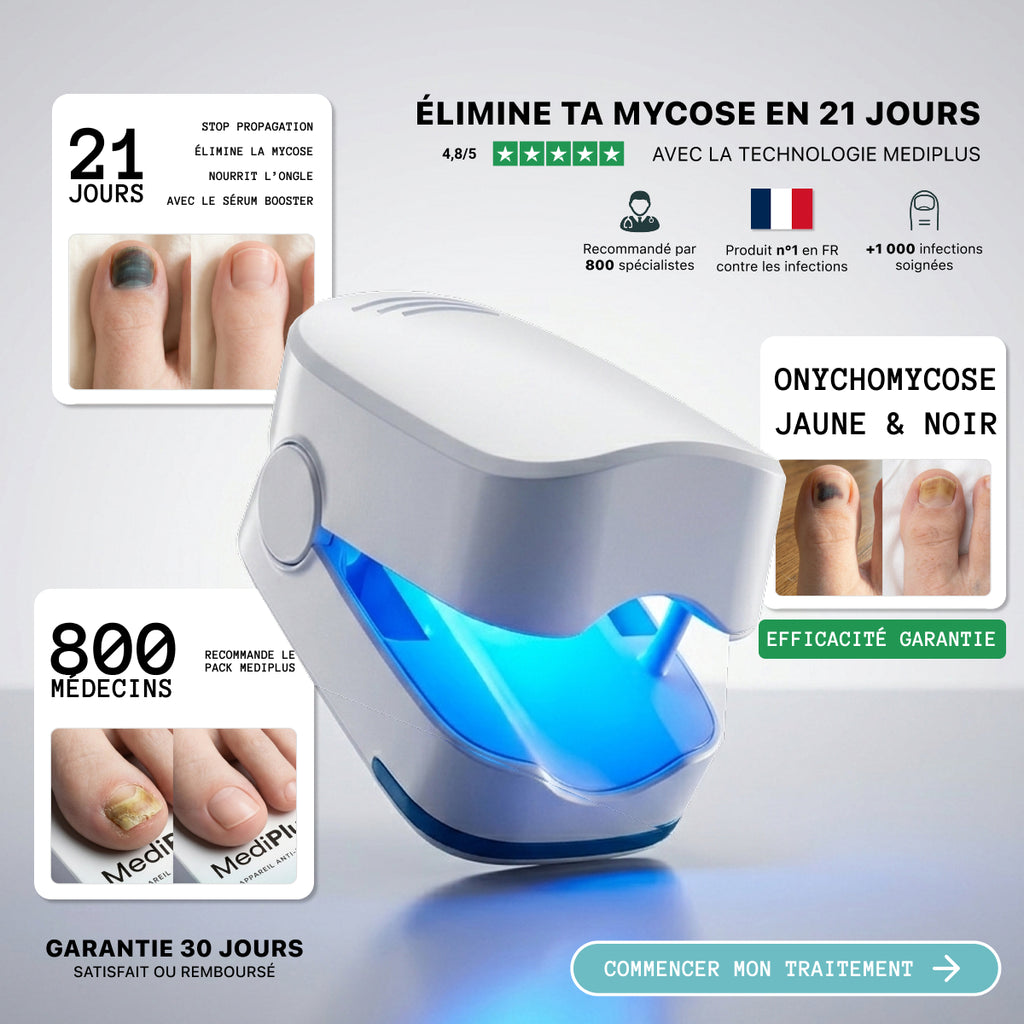 Appareil MediPlus Anti-Mycose ™