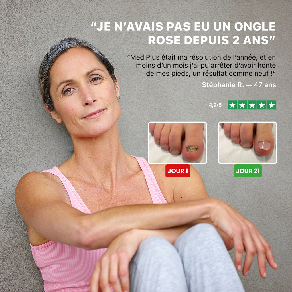 Appareil MediPlus Anti-Mycose ™